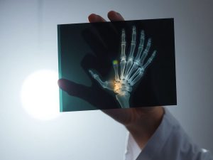 Medic analizând o radiografie, înțelegând rapid imaginea.